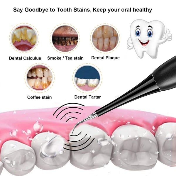 Electric Ultrasonic tooth cleaner