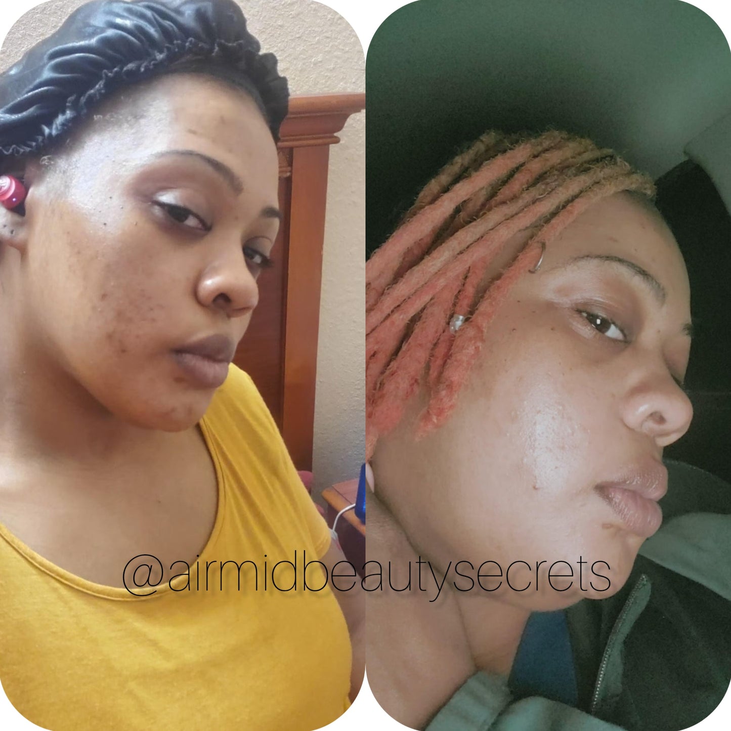 Organic Turmeric Soap for Radiant Skin