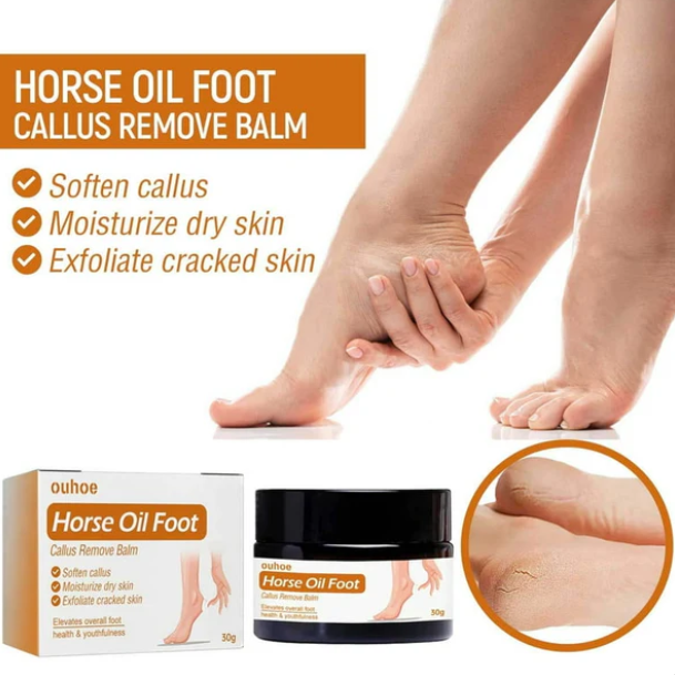 Horse Oil Foot Callus Remedy Balm YT